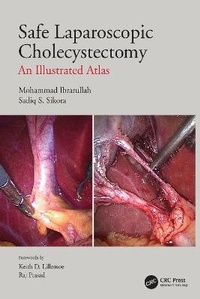 Enlarge image Cover: Safe Laparoscopic Cholecystectomy - CRC Press