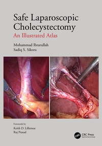 Enlarge image Cover: Safe Laparoscopic Cholecystectomy - CRC Press