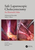 Cover: Safe Laparoscopic Cholecystectomy - CRC Press