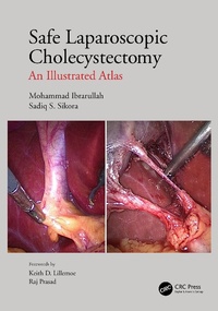 Abbildung von: Safe Laparoscopic Cholecystectomy - CRC Press