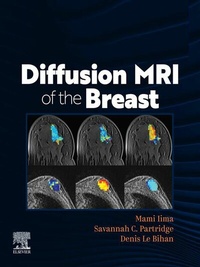 Abbildung von: DIFFUSION MRI OF THE BREAST, E-Book - Elsevier