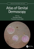 Cover: Atlas of Genital Dermoscopy - CRC Press