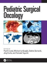 Abbildung von: Pediatric Surgical Oncology - CRC Press