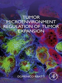 Bild: Tumor Microenvironment Regulation of Tumor Expansion - Academic Press