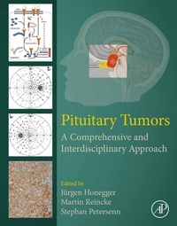 Abbildung von: Pituitary Tumors - Academic Press