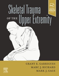 Abbildung von: Skeletal Trauma of the Upper Extremity, E-Book - Elsevier