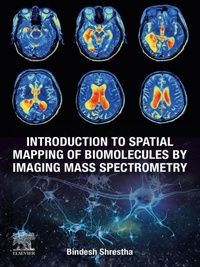 Bild: Introduction to Spatial Mapping of Biomolecules by Imaging Mass Spectrometry - Elsevier