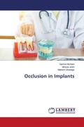 Cover: Occlusion in Implants - LAP Lambert Academic Publishing