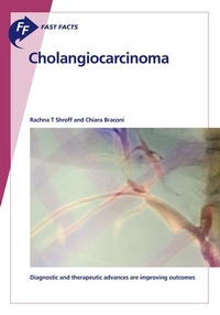 Abbildung von: Fast Facts: Cholangiocarcinoma - S. Karger