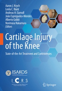 Abbildung von: Cartilage Injury of the Knee - Springer