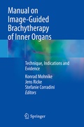 Cover: Manual on Image-Guided Brachytherapy of Inner Organs - Springer