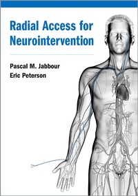 Abbildung von: Radial Access for Neurointervention - OUP eBook