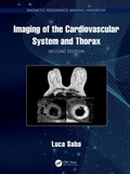 Cover: Imaging of the Cardiovascular System and Thorax - CRC Press