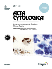 Abbildung von: Acta Cytologica - S. Karger