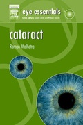 Cover: Cataract - Butterworth-Heinemann