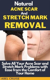 Abbildung von: Natural Acne Scar and Stretch Mark Removal - Jessie Addison