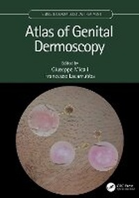 Enlarge image Cover: Atlas of Genital Dermoscopy - CRC Press