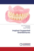 Cover: Implant Supported Overdentures - LAP Lambert Academic Publishing