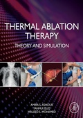 Bild: Thermal Ablation Therapy - Academic Press