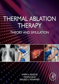 Bild: Thermal Ablation Therapy - Academic Press