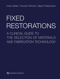 Abbildung von: Fixed Restorations - Quintessenz Verlags GmbH
