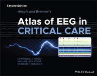 Abbildung von: Hirsch and Brenner's Atlas of EEG in Critical Care - Wiley