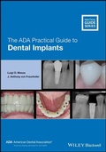 Cover: The ADA Practical Guide to Dental Implants - Wiley