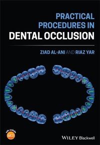 Abbildung von: Practical Procedures in Dental Occlusion - Wiley-Scrivener