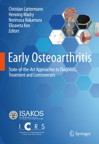 Abbildung von: Early Osteoarthritis - Springer