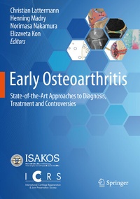 Abbildung von: Early Osteoarthritis - Springer