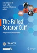 Cover: The Failed Rotator Cuff - Springer