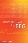 Abbildung von: How to Read an EEG - Cambridge University Press