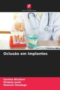 Cover: Oclusao em Implantes - Edicoes Nosso Conhecimento