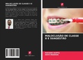 Cover: Maloclusao de Classe II E Suagestao - Edicoes Nosso Conhecimento