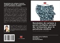 Cover: Nanotubes de carbone a parois multiples portant de l'artesunate pour le paludisme cerebral - Editions Notre Savoir