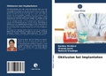 Cover: Okklusion bei Implantaten - Verlag Unser Wissen