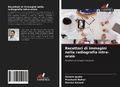 Cover: Recettori di immagini nella radiografia intra-orale - Edizioni Sapienza