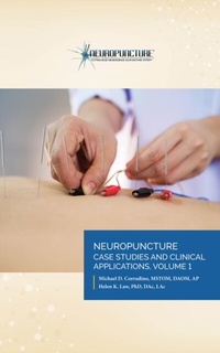 Abbildung von: Neuropuncture(TM) Case Studies and Clinical Applications - Neuropuncture Inc.