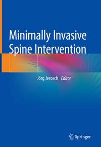 Abbildung von: Minimally Invasive Spine Intervention - Springer