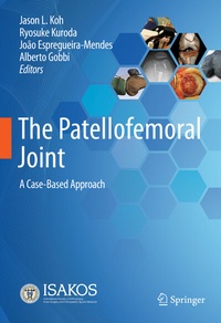 Abbildung von: The Patellofemoral Joint - Springer