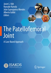 Abbildung von: The Patellofemoral Joint - Springer