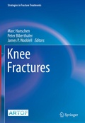Cover: Knee Fractures - Springer