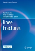 Cover: Knee Fractures - Springer