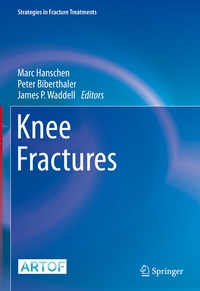 Enlarge image Cover: Knee Fractures - Springer