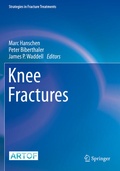 Cover: Knee Fractures - Springer