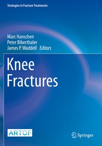 Enlarge image Cover: Knee Fractures - Springer