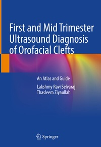 Abbildung von: First and Mid Trimester Ultrasound Diagnosis of Orofacial Clefts - Springer