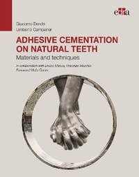 Abbildung von: Adhesive cementation on natural teeth - Materials and techniques - Edra Spa