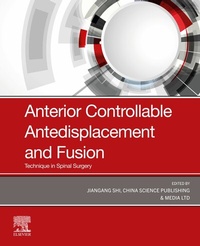 Abbildung von: Anterior Controllable Antedisplacement and Fusion (ACAF) - Elsevier