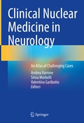 Abbildung von: Clinical Nuclear Medicine in Neurology - Springer